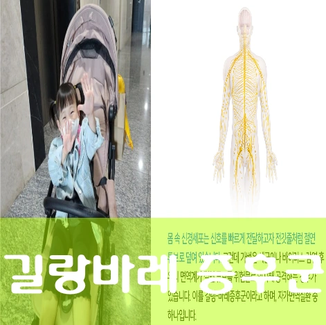 길랑바레 증후군 