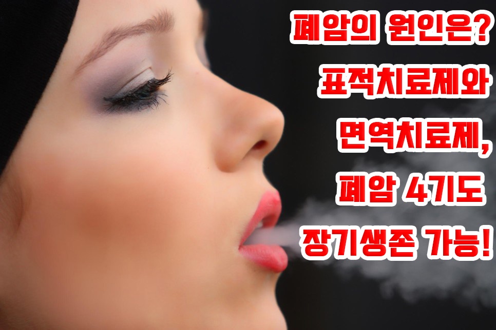  폐암의 원인? 표적치료제, 면역항암제로 폐암 4기도 장기생존 가능!