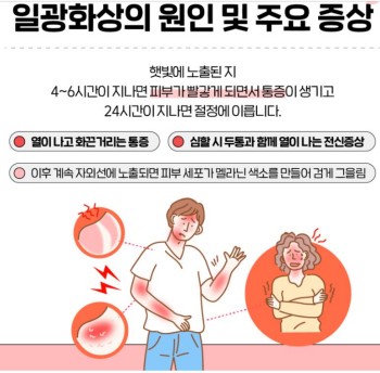 일광화상증상