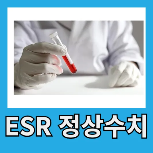 20~50세 정상 ESR 수치