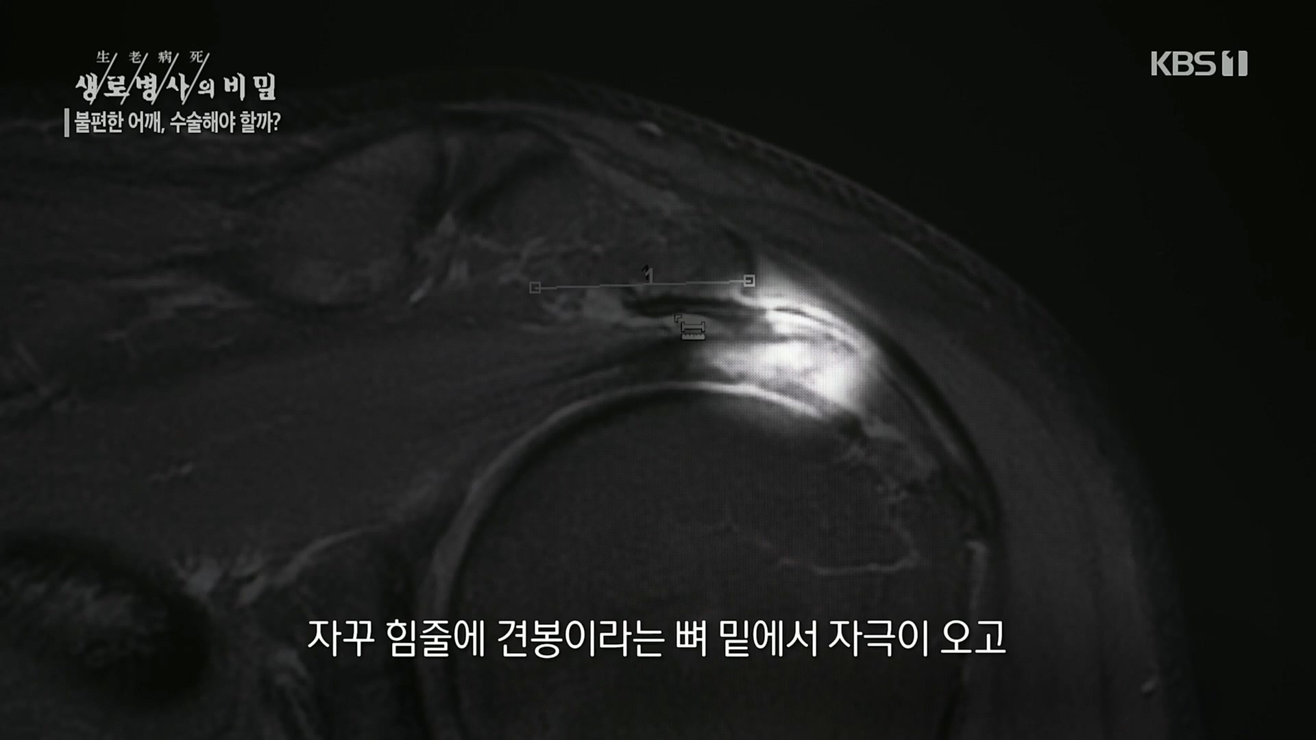 생로병사의 비밀.E848.221221p.H264-F1RST.mp4_20221222_200743.536.jpg
