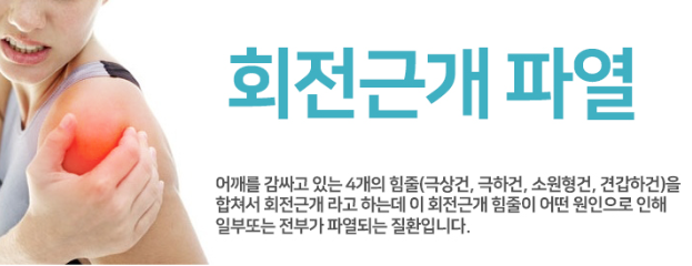 회전근개 파열