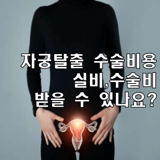 자궁탈출증 썸네일