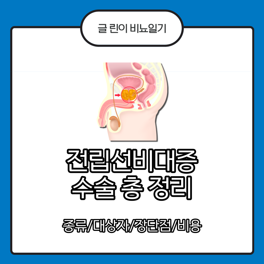  전립선비대증 수술 총 정리