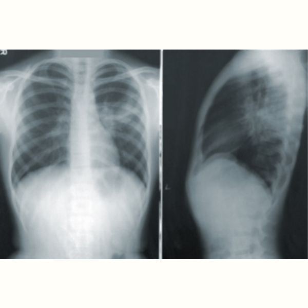 빠르게 맞추는 방법 방사선사 국가고시 응시자격 4