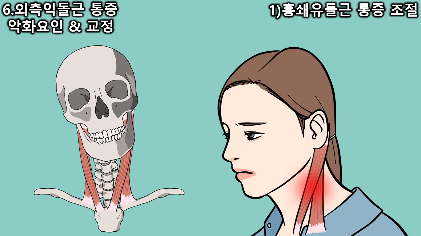 외측익돌근(가쪽 날개근) 완벽해부와 외익돌근(외익상근) 통증 해결