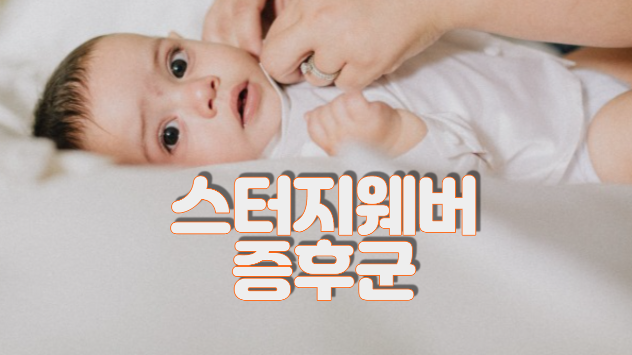  스터지웨버 증후군