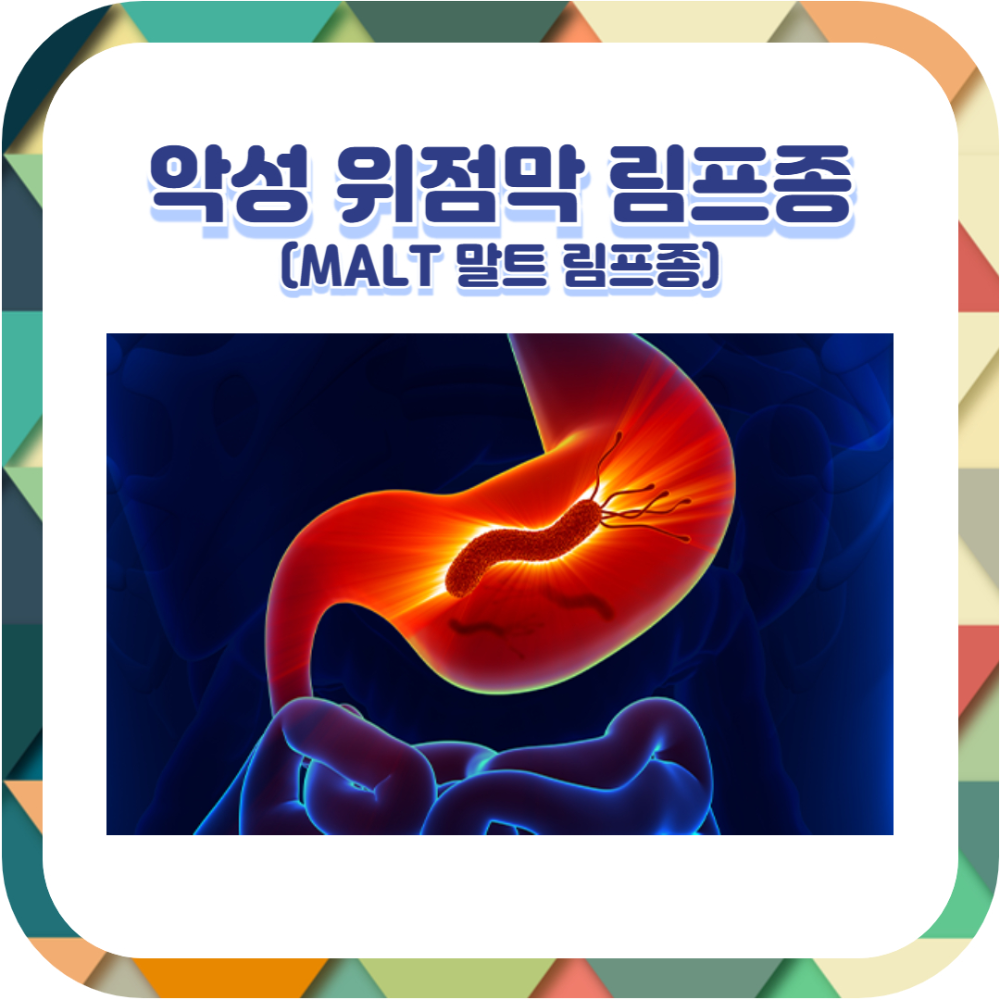 악성 MALT 말트 림프종 ❘ 증상 ❘ 원인 ❘ 진단 ❘ 치료 ❘ 예후 ❘ 관리