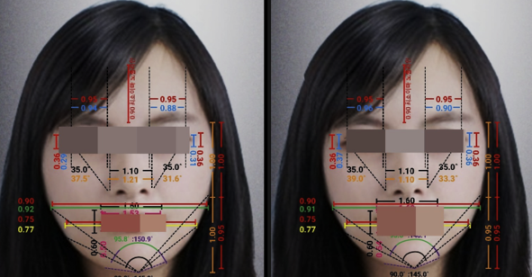미리해봐 얼굴 상태 수치화