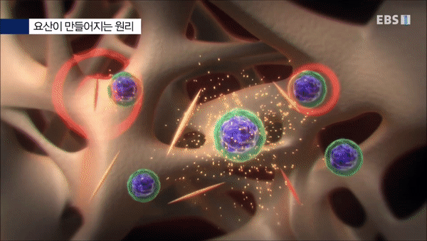  (명의) 통풍, 바람만 스쳐도 아프다