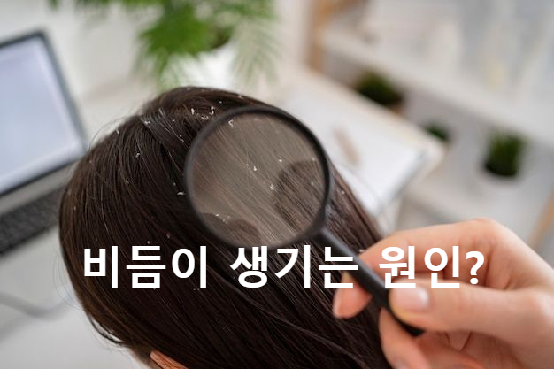 돋보기로 머리 보는 사진