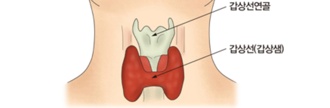 갑상선-기능-저하증