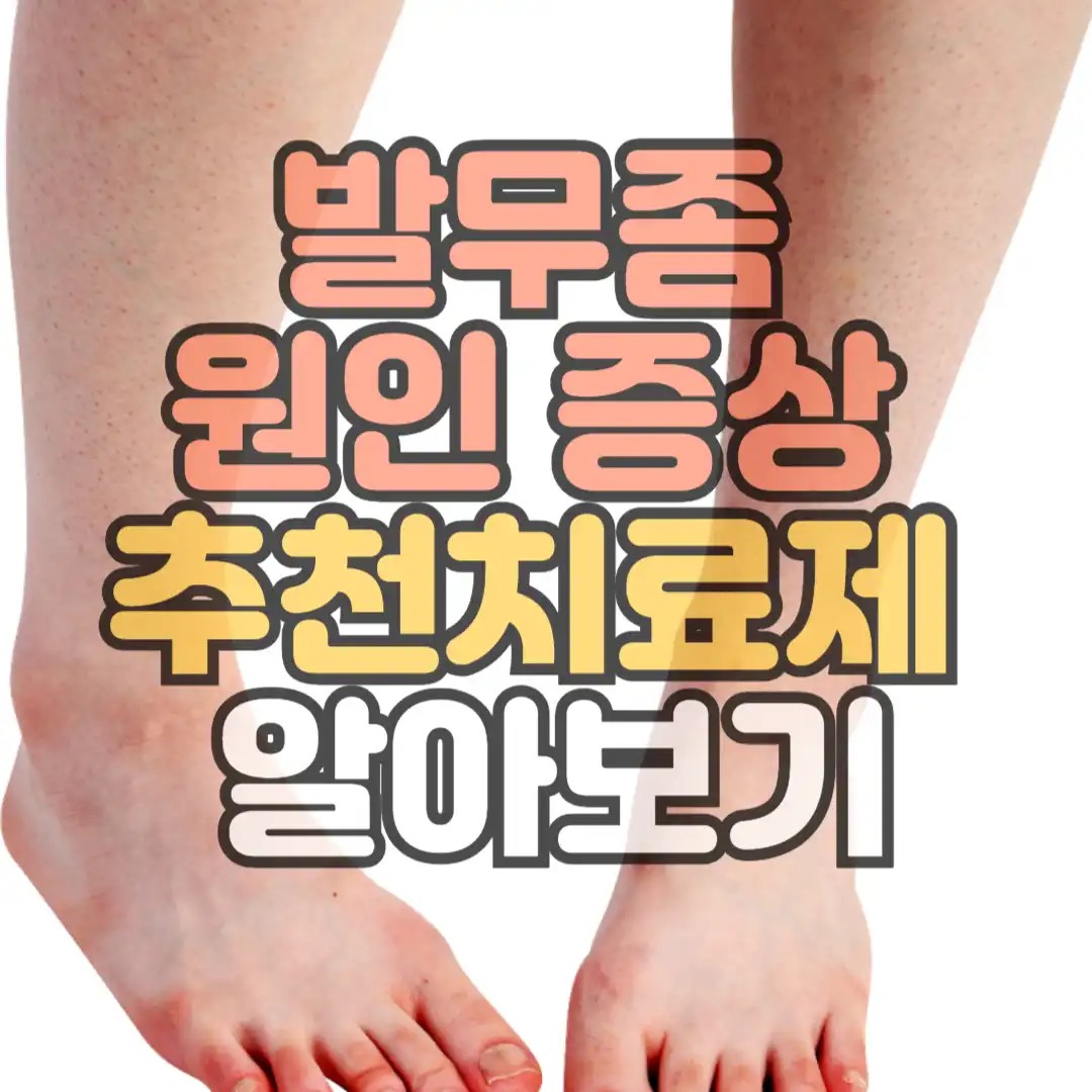 발무좀증상 추천치료제