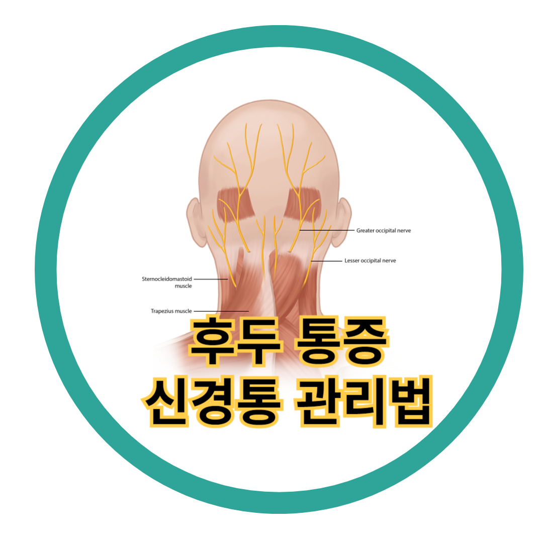  후두 통증과 후두신경통 관리법