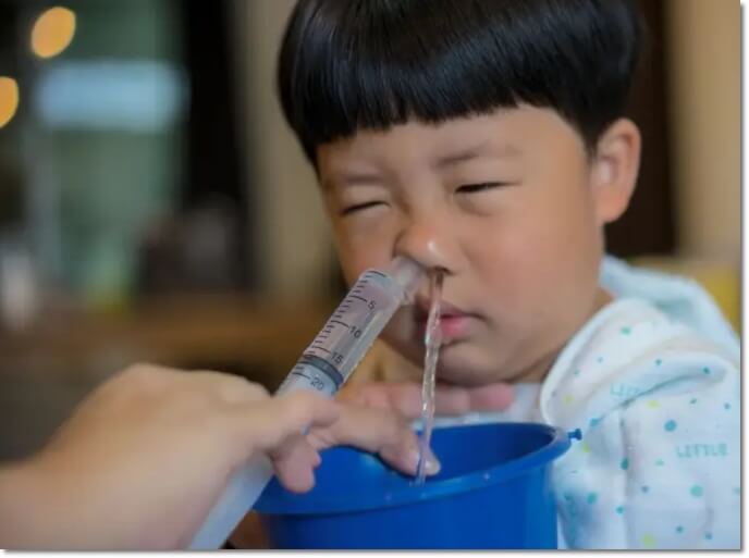 콧물-식염수 세척하는-모습