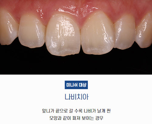 나비치아