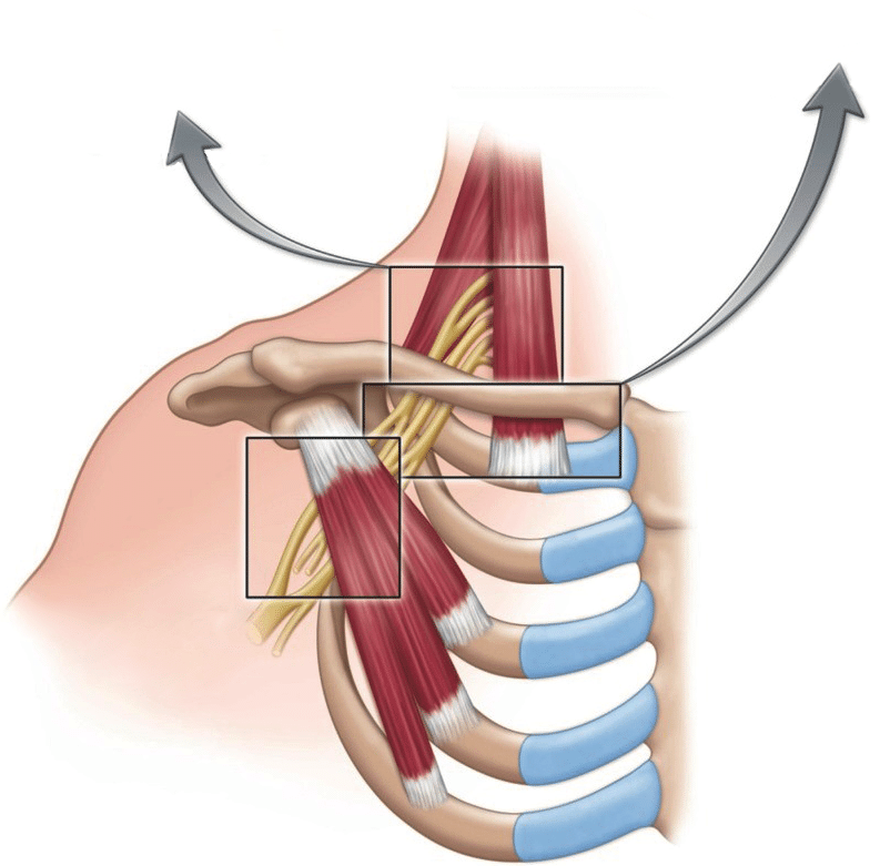 Costoclavicular compression test. Shoulder retracted and depressed