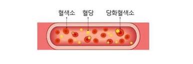 당화혈색소 낮추는 방법