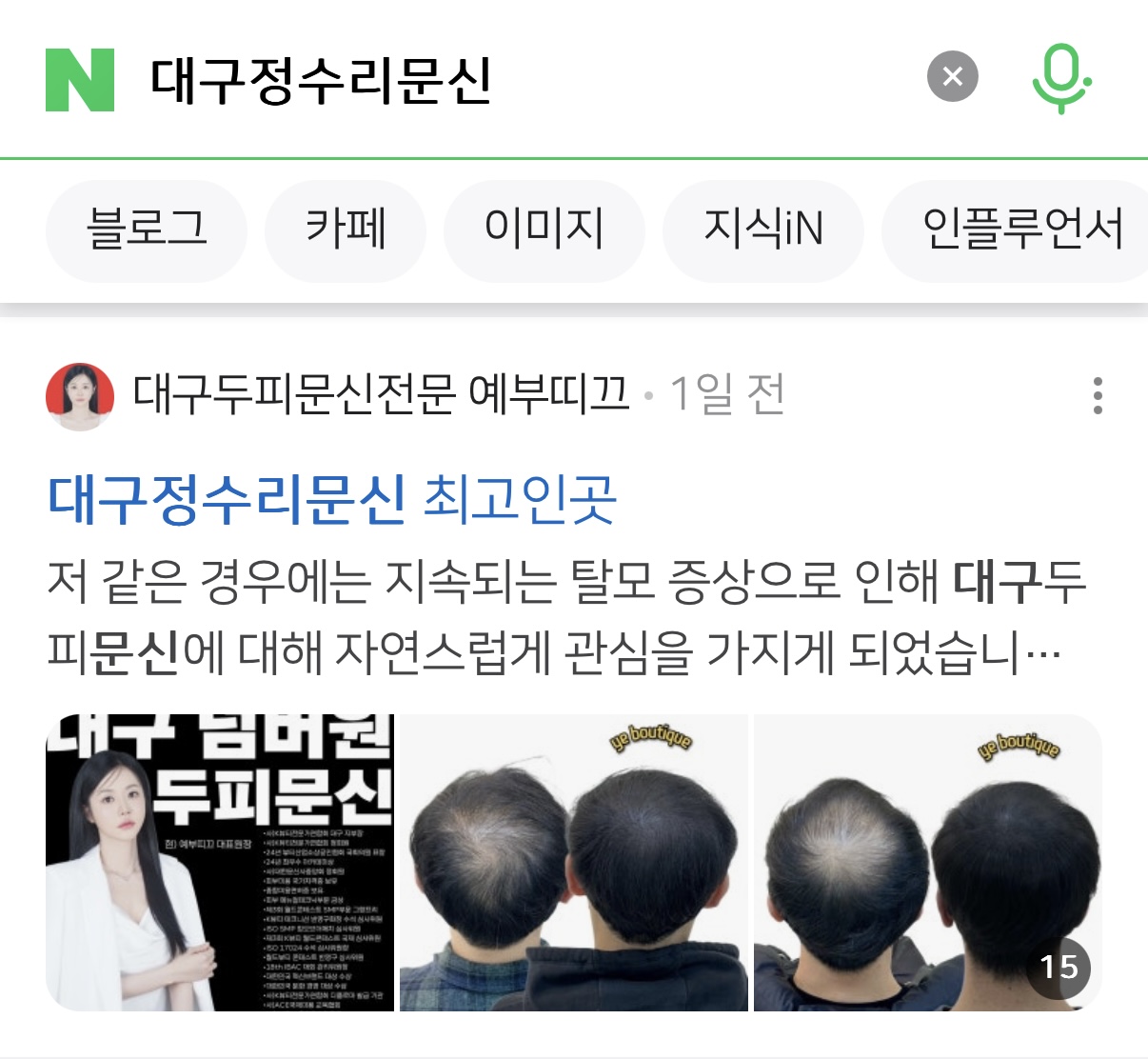 부띠끄서 이미지