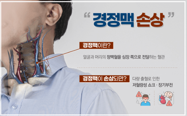 경정맥 손상 위험 후유증 이재명대표상황