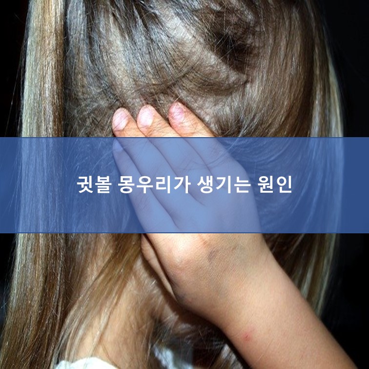  귓볼에 갑자기 몽우리가 생기는 원인
