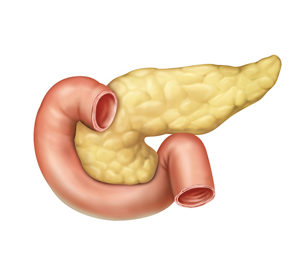췌장암 초기증상