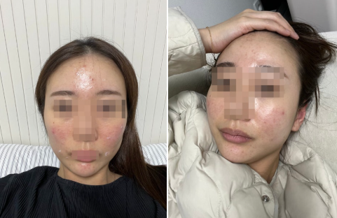 에보덤 판토힐 내돈내산 후기 사진
