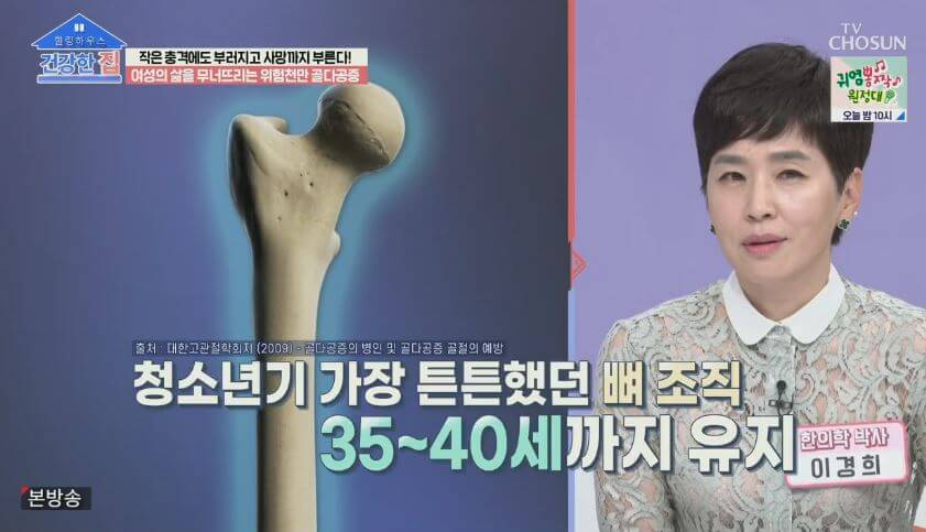 뼈관리 잘해야 합니다.