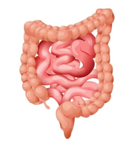 과민성 대장증후군 치료법