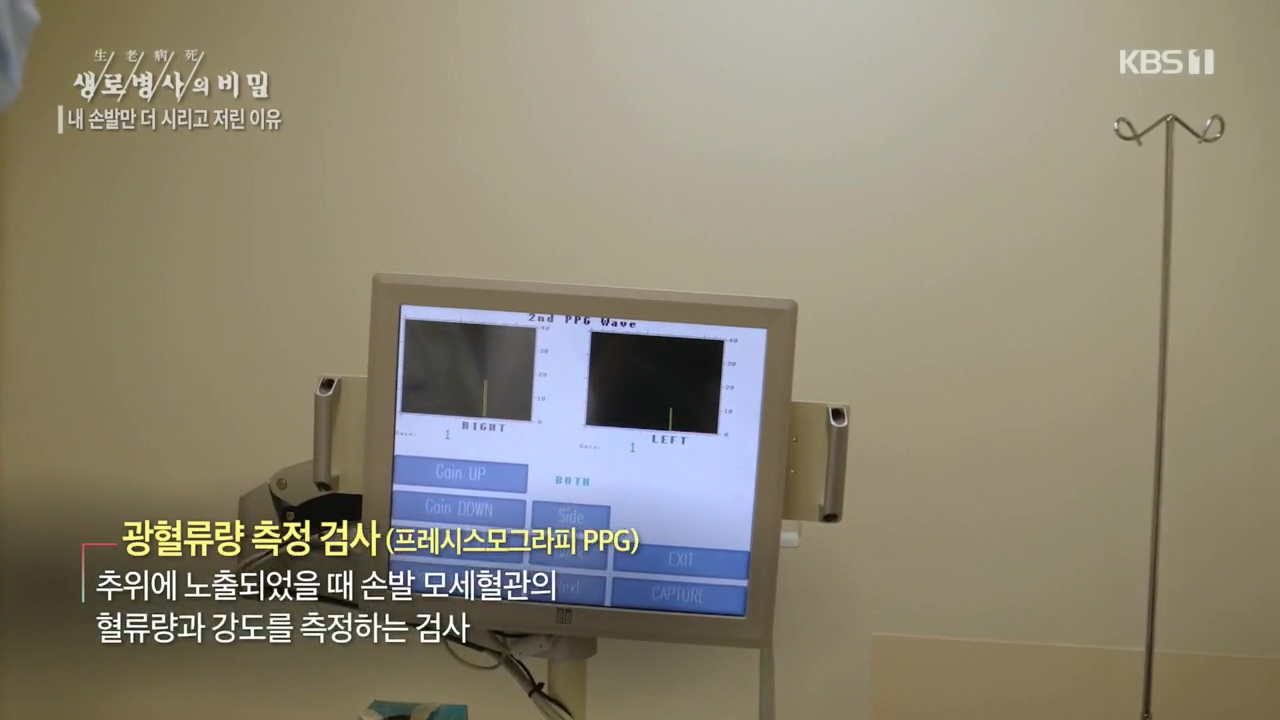 생로병사의 비밀.E847.221215p.H264-F1RST.mp4_20221215_194608.720.jpg