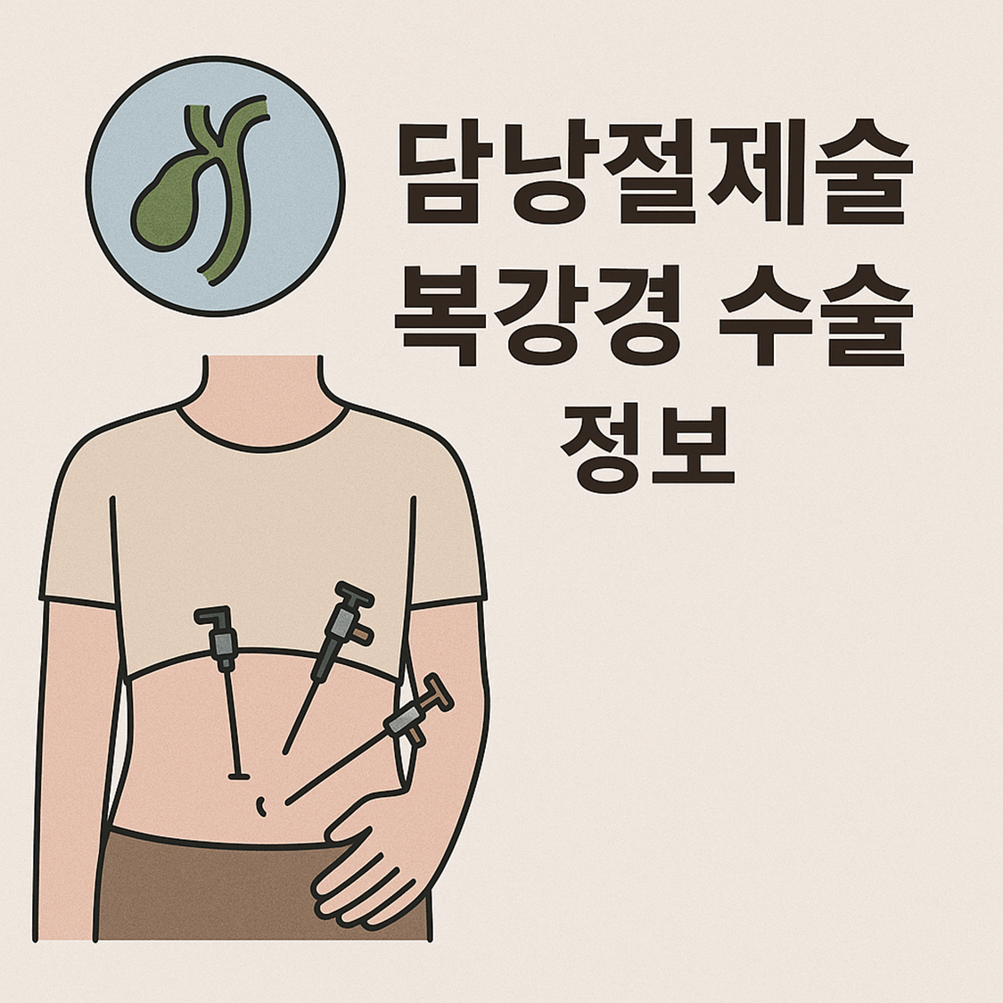 담낭절제술 복강경 수술 정보
