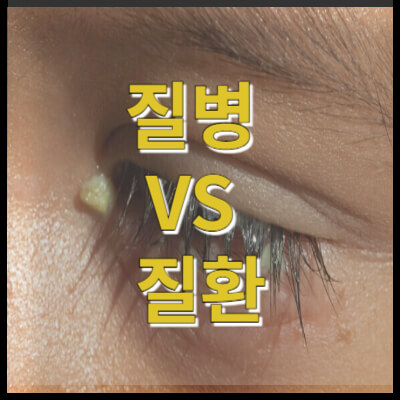 질병 vs 질환: 그들 사이의 중요한 차이점은?