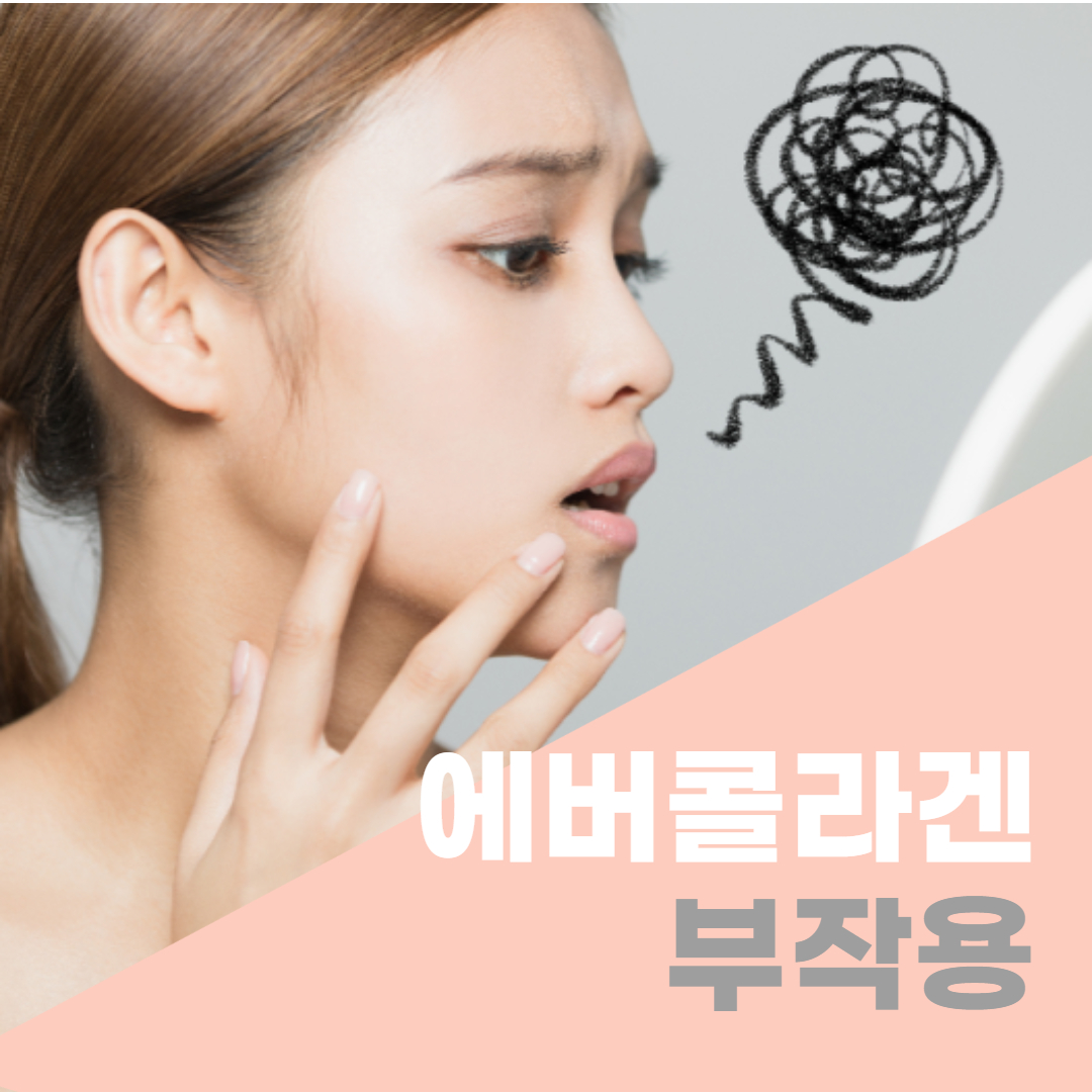  에버콜라겐 부작용 / 콜라겐 종류별 부작용