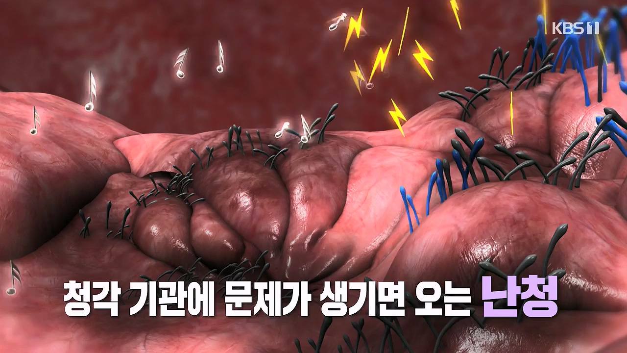 생로병사의 비밀.E883.230914p-NEXT.mp4_20230914_204612.138.jpg
