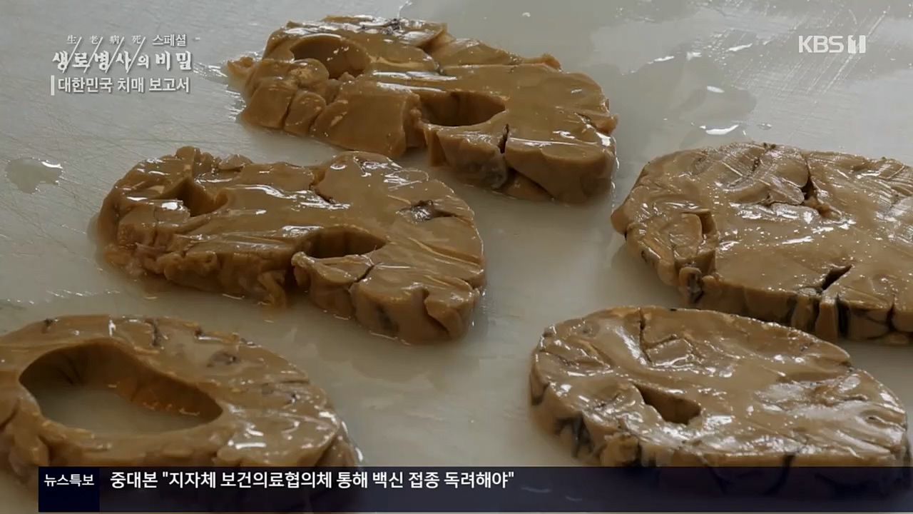 생로병사의 비밀.E843.221117p.H264-F1RST.mp4_20221122_193546.726.jpg