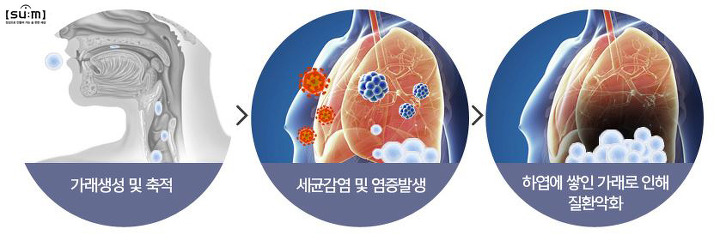 기침가래