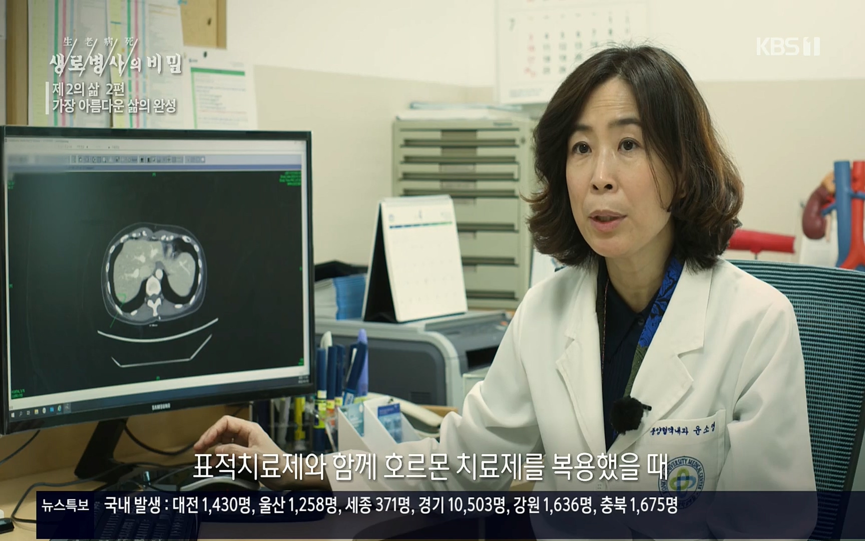 생로병사의 비밀.E820.220511p.H264-F1RST.mp4_20220512_190319.250.jpg