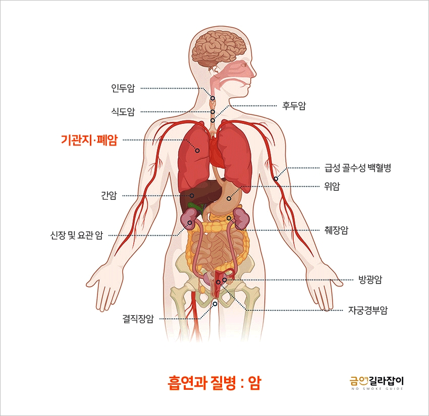 [흡연과 암]