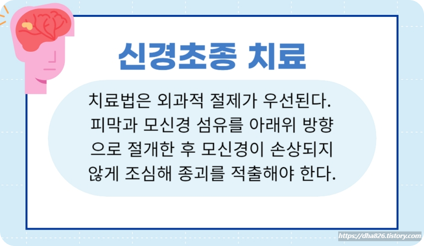 신경초종 치료