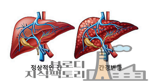 우루사 100mg 200mg