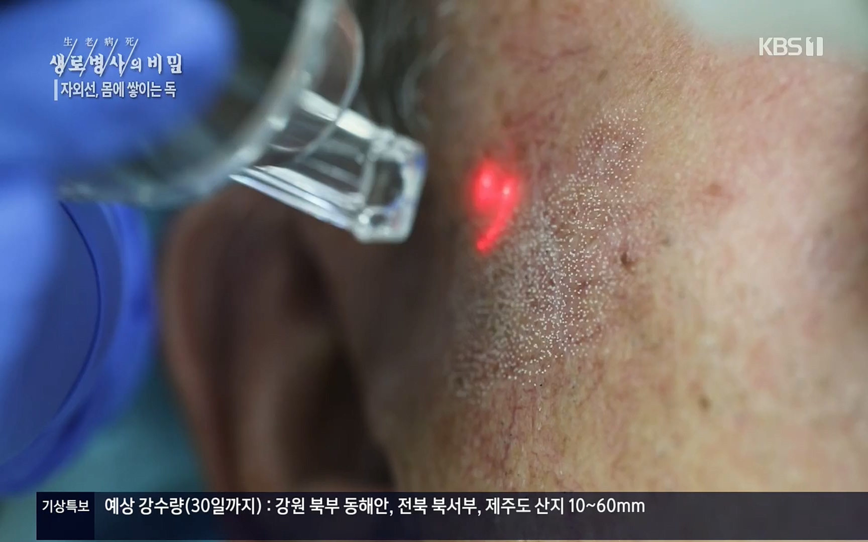 생로병사의 비밀.E824.220629p.H264-F1RST.mp4_20220630_205905.447.jpg