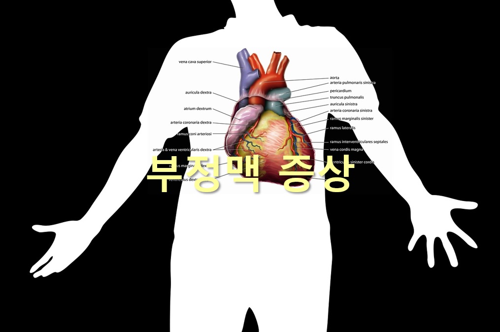  부정맥 증상과 부정맥 치료 방법