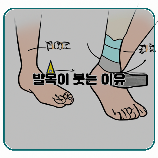 -발목-붓다-치료법