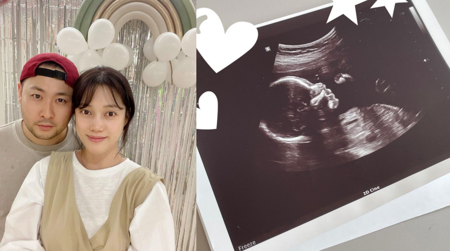  에픽하이 미쓰라 진 아내 권다현 득남 와이프 나이 출산 부인 직업 무엇?