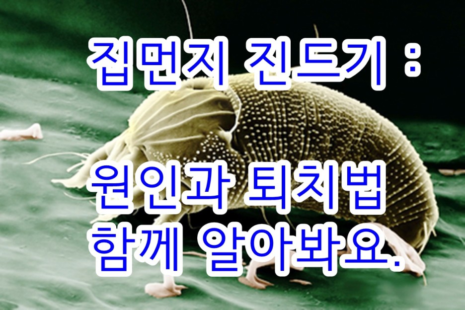  집먼지진드기 원인과퇴치법에 대하여 알아봐요.