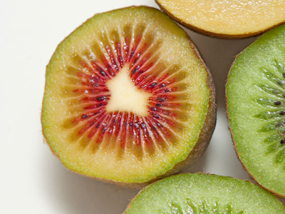 키위 효능 10가지 9
