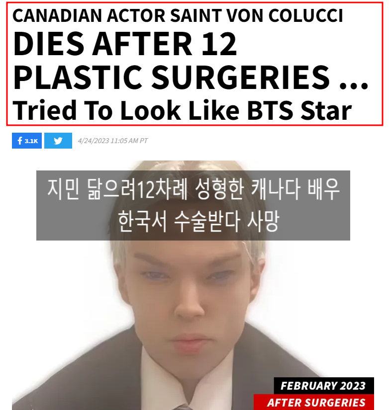  BTS 지민 닮으려 12차례 성형한 캐나다 배우 콜루치 한국서 수술받다 사망 향년 22세