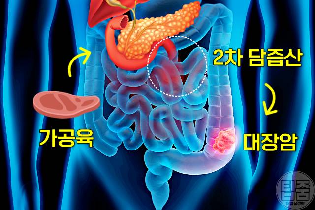 대장암 예방에 좋은 음식 대장암 예방을 위한 식단과 식습관