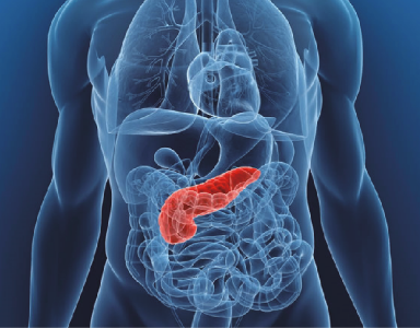 위암 사망률 앞선 이 &#39;암&#39;은? Can pancreatic cancer be prevented?