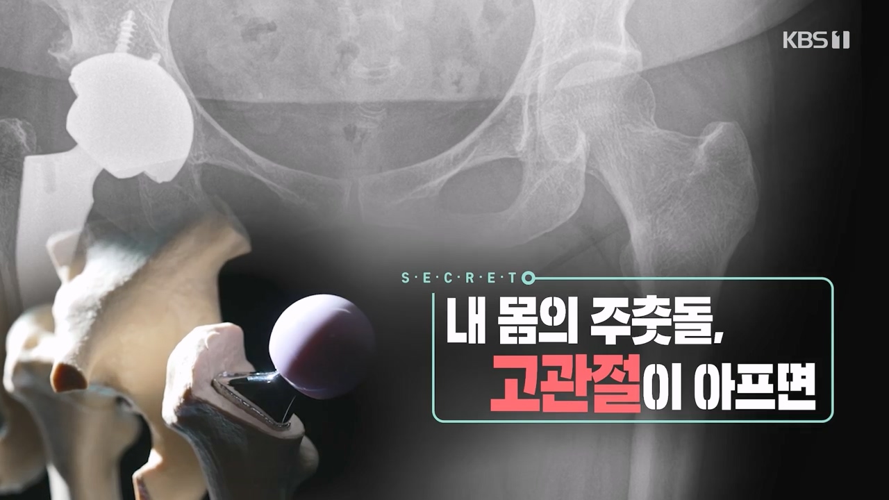 생로병사의 비밀.E890.231116p-NEXT.mp4_20231116_202709.277.jpg